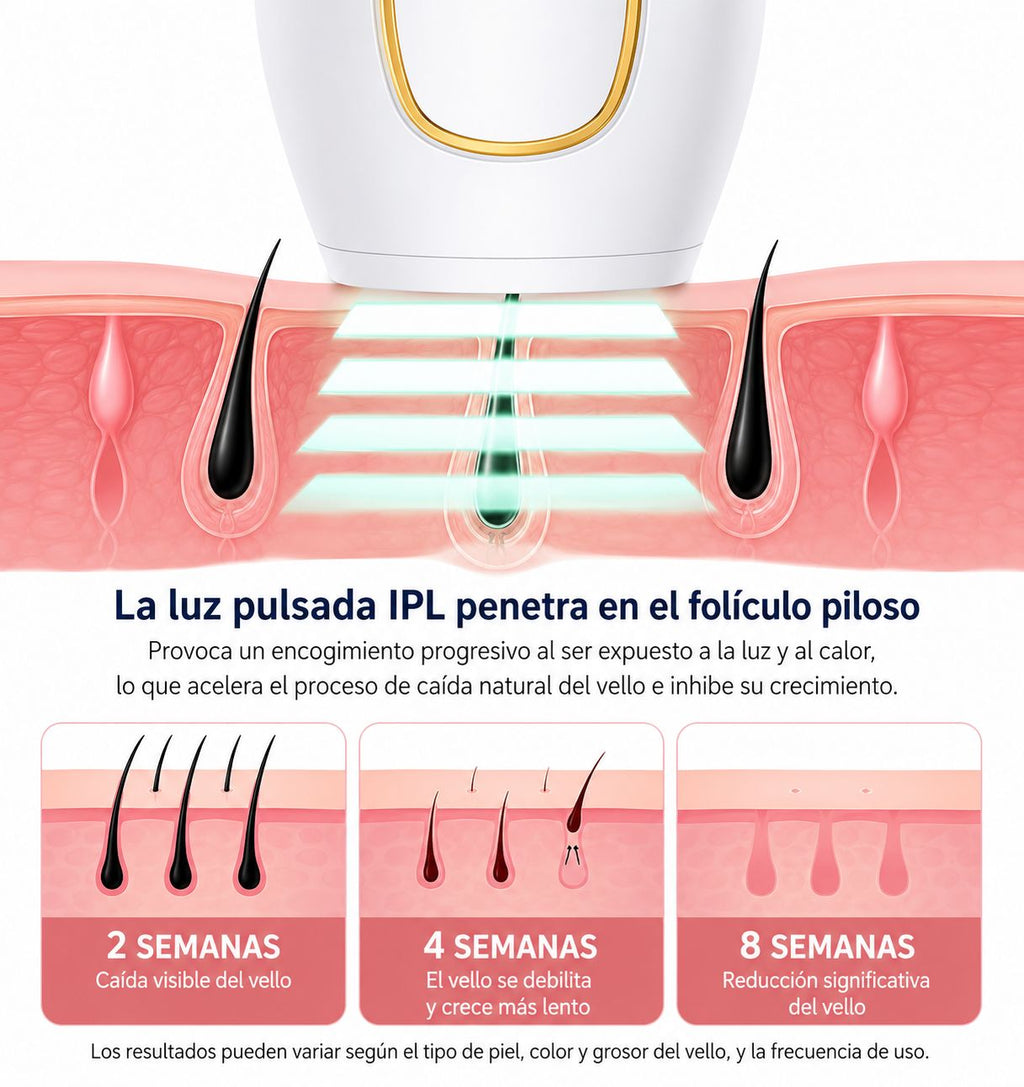 Depiladora Láser IPL